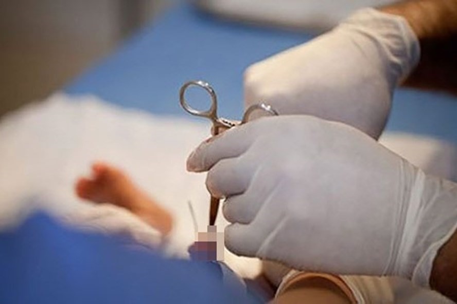 Nên cắt bao quy đầu ở đâu Hải Phòng