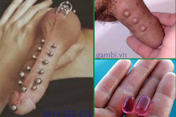 Găm bi dương vật tại Hải Phòng