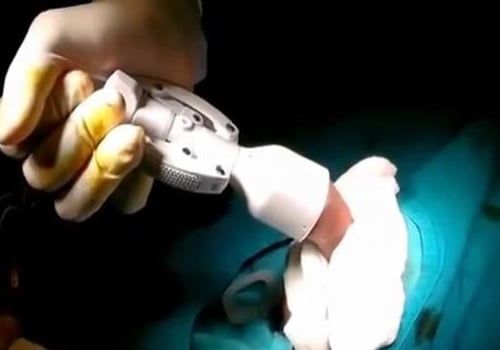 Cắt bao quy đầu ở đâu uy tín tại Hải Phòng