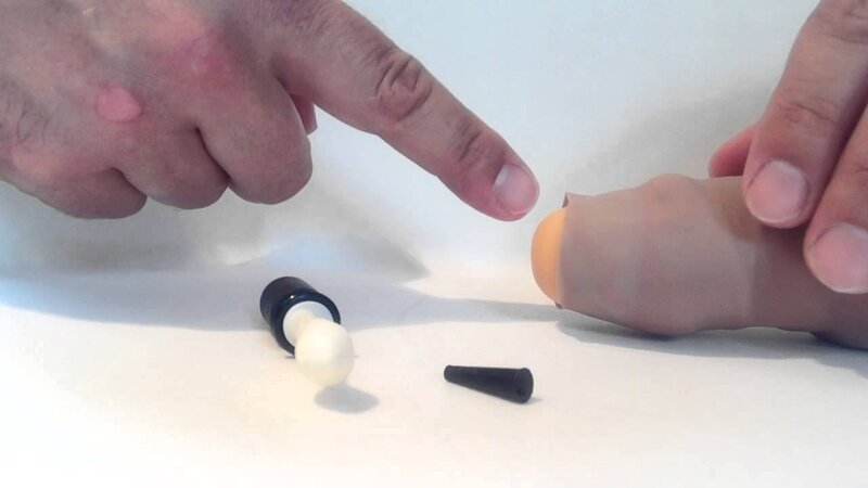 Cắt bao quy đầu do nghẹt Hải Phòng