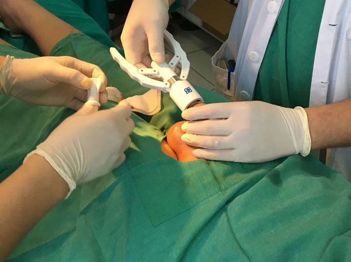 Nơi cắt bao quy đầu Hải Phòng